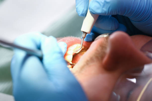 Best Weekend Emergency Dentist in Williamsburg, OH