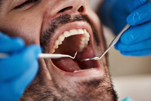Best Emergency Dental Care for Abscessed Tooth in Williamsburg, OH